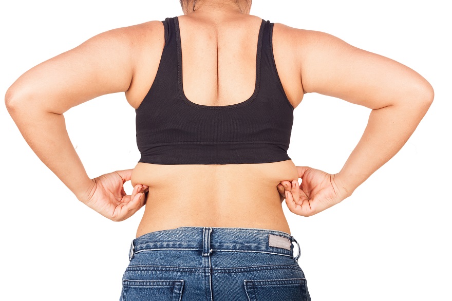 Bra Line Back Lift Cost, Risk & Recovery Info