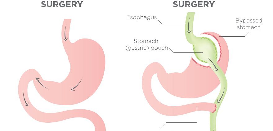 5 Proven Puravive Review Techniques